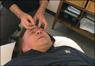 Joe Barth getting acupuncture treatment
